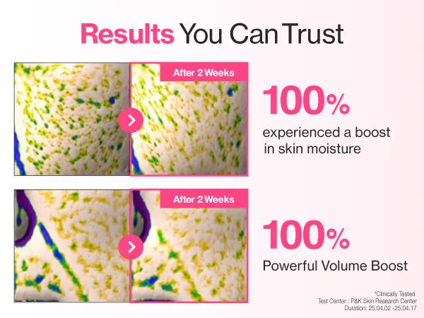 NUMBUZIN No.2 Rose PDRN Collagen Plumping Sheet Mask 5ea